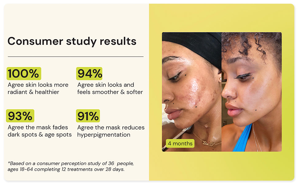 Zermet 1 Gleamin Vitamin C Clay Mask for Dark Spots, Turmeric Clay Face Mask Skin Care, Deeply Cleanses & Refines Pores, Brightens Uneven Tone and Helps Improve Post-Blemish Scarring & Texture, Up to 20 Uses