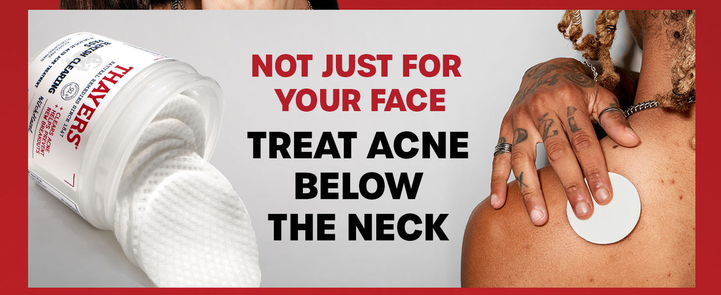 Zermet 1 Thayers Blemish Clearing Acne Pads, Salicylic Acid Acne Treatment for Face, Pore Reducing, Exfoliating, and Soothing Skincare, Witch Hazel Toner Pads, 60 Ct