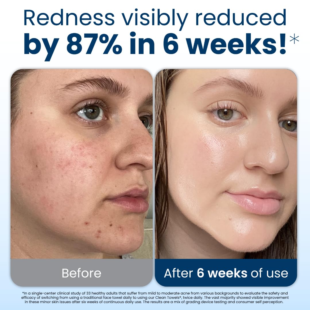 Zermet 1 Clean Skin Club Clean Towels XL™, 100% USDA Biobased Face Towel, Disposable Face Towelette, Eczema Association Accepted, Makeup Remover Dry Wipes, Ultra Soft, 50 Ct, 1 Pack