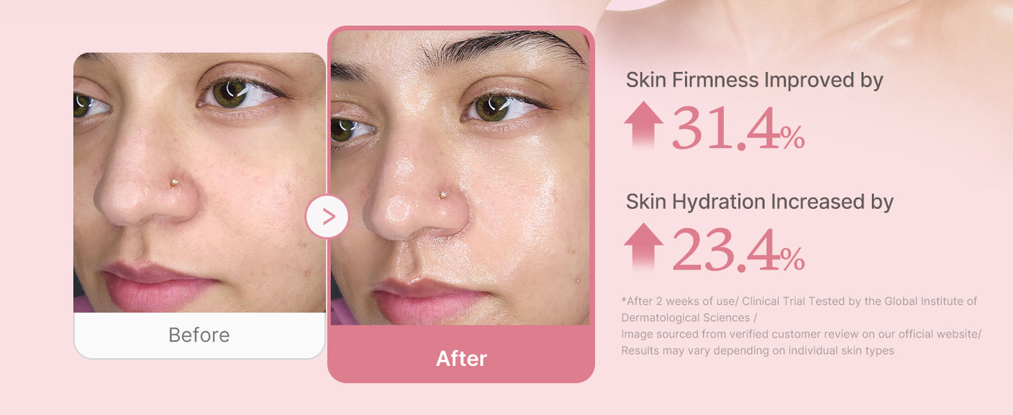 Zermet 1 medicube Collagen Overnight Wrapping Peel Off Facial Mask Pack - Elasticity & Hydration Care, Reduces Sagging & Dullness - Hydrolyzed Collagen For Glowing Skin - Korean Skin Care, 2.53 fl.oz