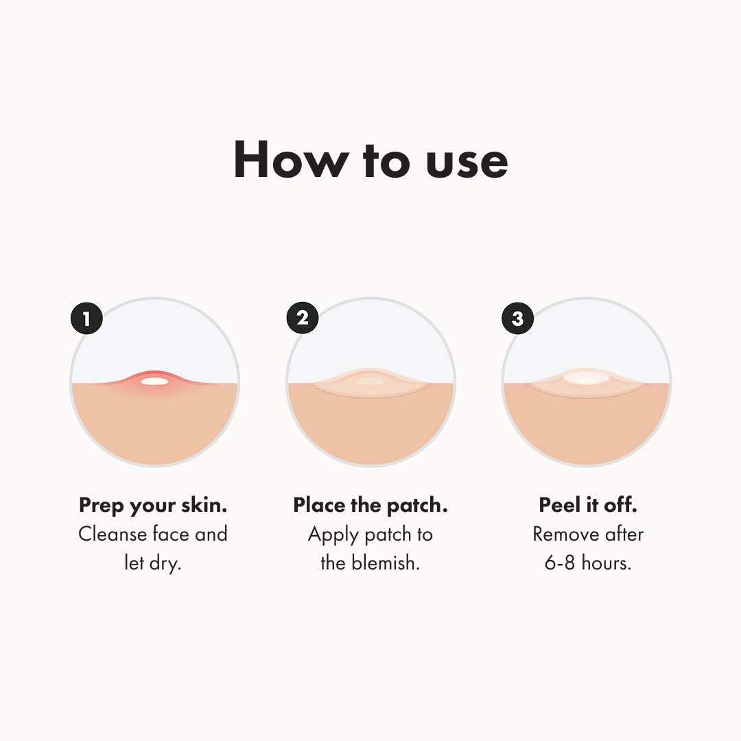 Zermet 1 Mighty Patch™ Original patch from Hero Cosmetics – The #1 Hydrocolloid Acne Pimple Patch for Shrinking Zits and Whiteheads in 1 use; Nighttime Spot Stickers for Face and Skin (36 Count)