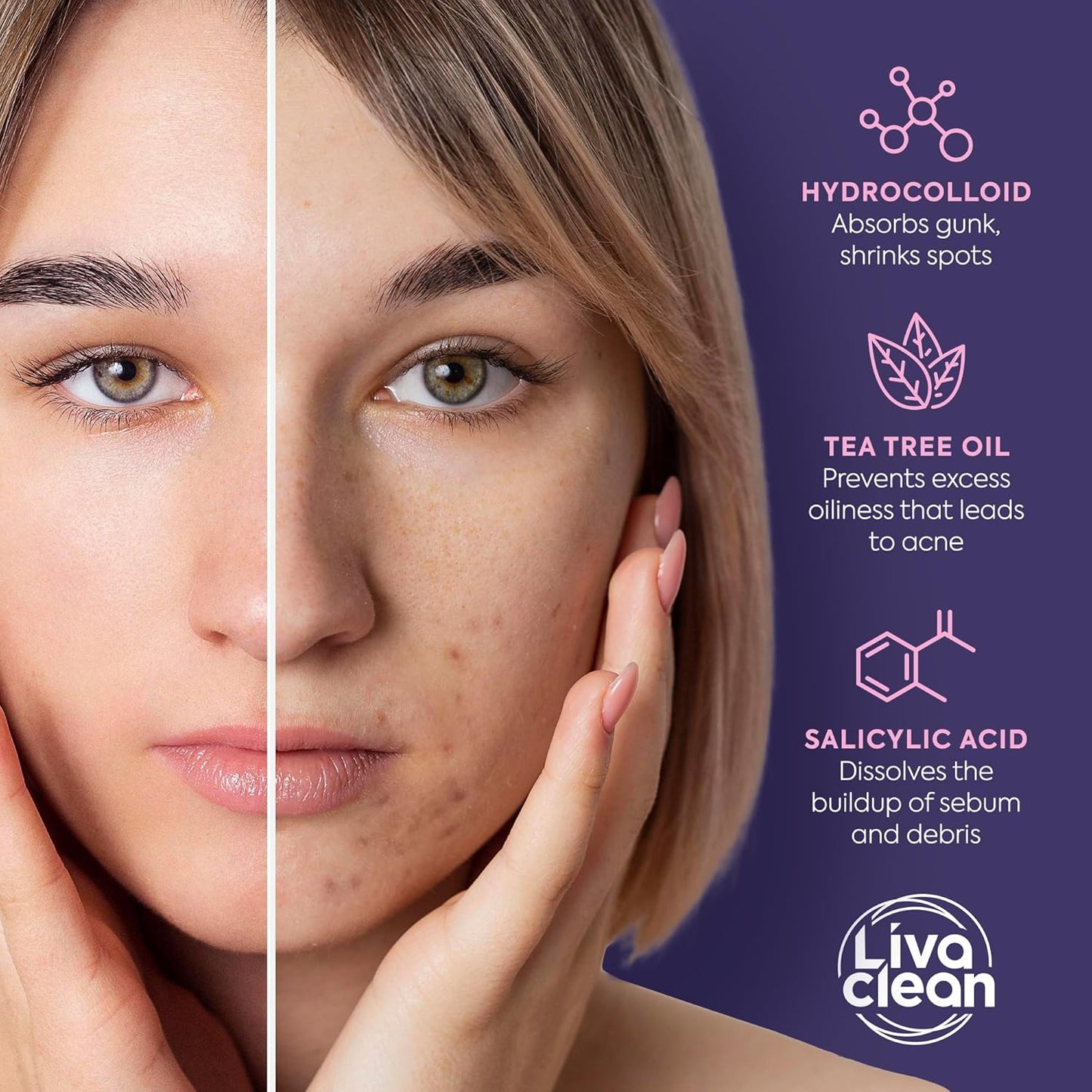 Zermet 1 LivaClean Star Pimple Patches for Face w/Hydrocolloid, Salicylic Acid & Tea Tree, 240 Patches, Hydrocolloid Acne Patch, Cute Star Pimple Patch for Healing Stickers Zit Superstar