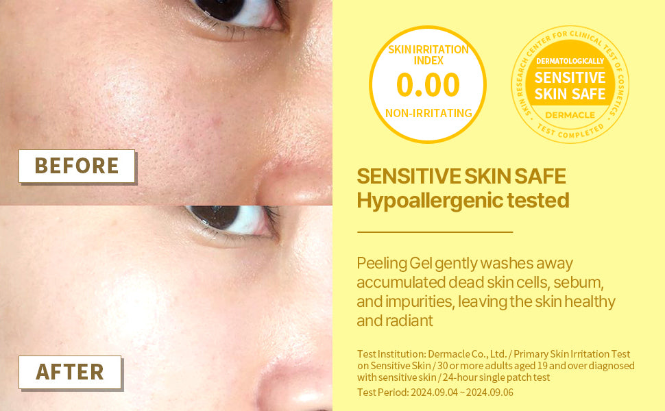 Lemon Sparkling Peeling Gel Deep Cleanse Exfoliate