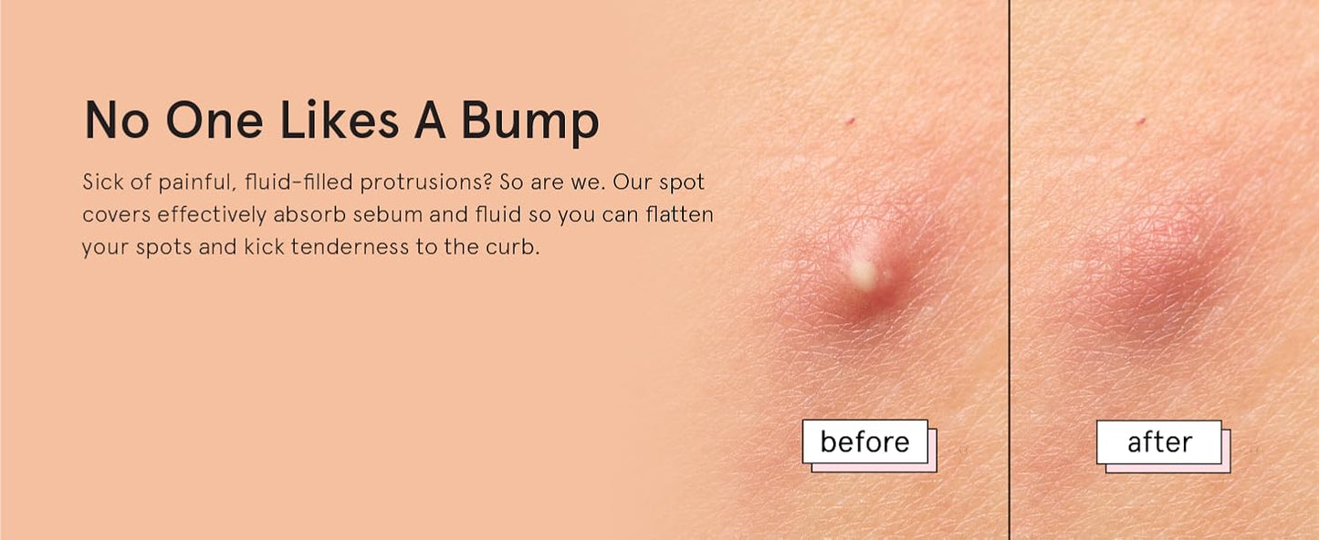 Zermet 1 grace & stella Award Winning Pore Strip - Pimple Patches for Face - Hydrocolloid Acne Patches - Absorbs Zits, Reduces Redness - Cute Patches Dermatologist-Tested, Vegan (Multishape, 36 Count)