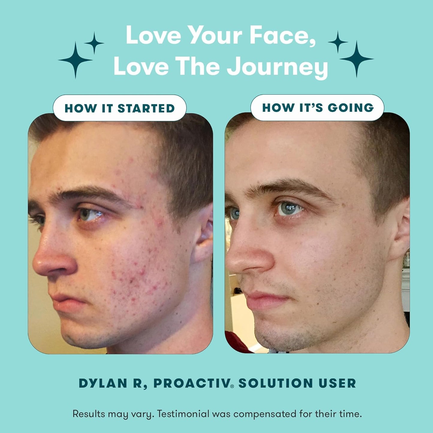 Zermet 1 Proactiv 3 Step Acne Treatment - Benzoyl Peroxide Face Wash, Repairing Acne Spot Treatment for Face and Body, Exfoliating Toner - 30 Day Complete Acne Skin Care Kit