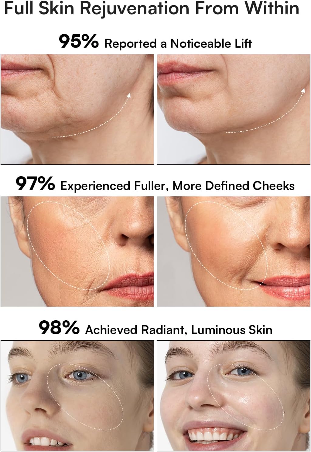 Zermet 1 Zermet 1 3-in-1 Red Light Therapy for Face and Neck Facial Massager True Beauty Glow Device, Lifting & Firming Skincare Tool