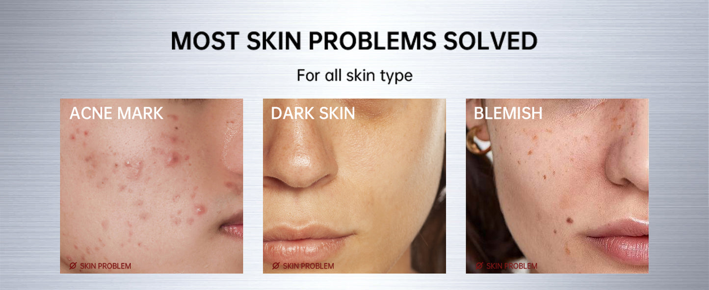 Zermet 1 Zermet 1  Skin Care Set, with Snail Mucin 92% Moisturizer 1.76 Oz & Vitamin C Face Serum 1.01 Oz, Daily Hydrating & Firming Skincare Routine Kit for All Skin Type