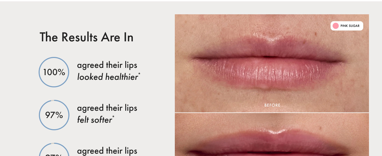 Zermet 1 Summer Fridays Tinted Lip Butter Balm - Conditioning Vegan Lip Balm for Instant Moisture, Shine & Hydration - Sheer-Tinted, Soothing Skincare - Pink Sugar (.5 Oz)