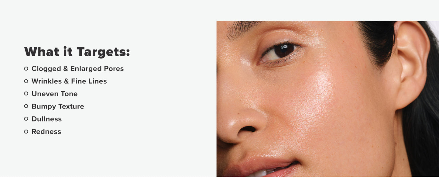 Zermet 1 Paula's Choice SKIN PERFECTING 2% BHA Liquid Exfoliant Polish, Salicylic Acid Facial Exfoliator Polish for Enlarged Pores, Wrinkles & Fine Lines, Suitable for Blackhead-Prone Skin, Fragrance-Free