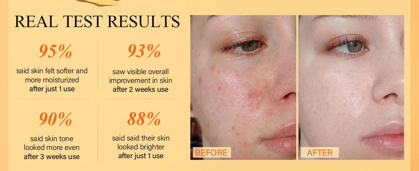 Zermet 1 Vitamin C Face Mask with Kaolin Clay and Turmeric for Dark Spots, Dull Skin, Skincare Facial Mask for Controlling Oil and Refining Pores 5.29 Oz