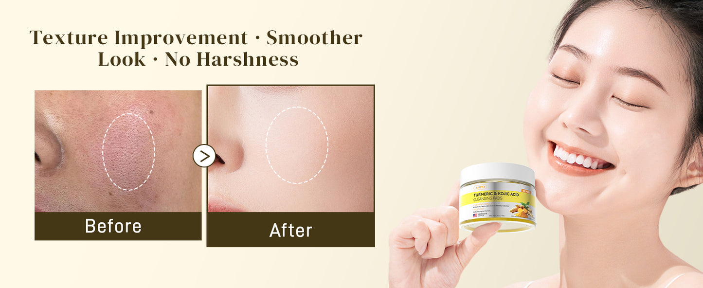 Zermet 1 Kojic Acid and Turmeric Cleansing Pads, 50 Pcs, for Face Cleansing and Exfoliation