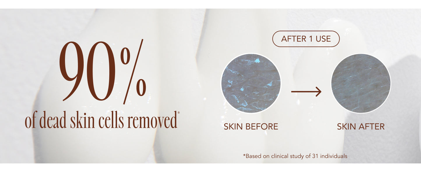 Zermet Facial Polish - Daily Peeling Gel with Panthenol & AHA/BHA, Gentle Exfoliator for Smooth, Glowing and Hydrated Skin, Deep Cleansing, Korean Skin Care, 5.07 Fl. Oz.