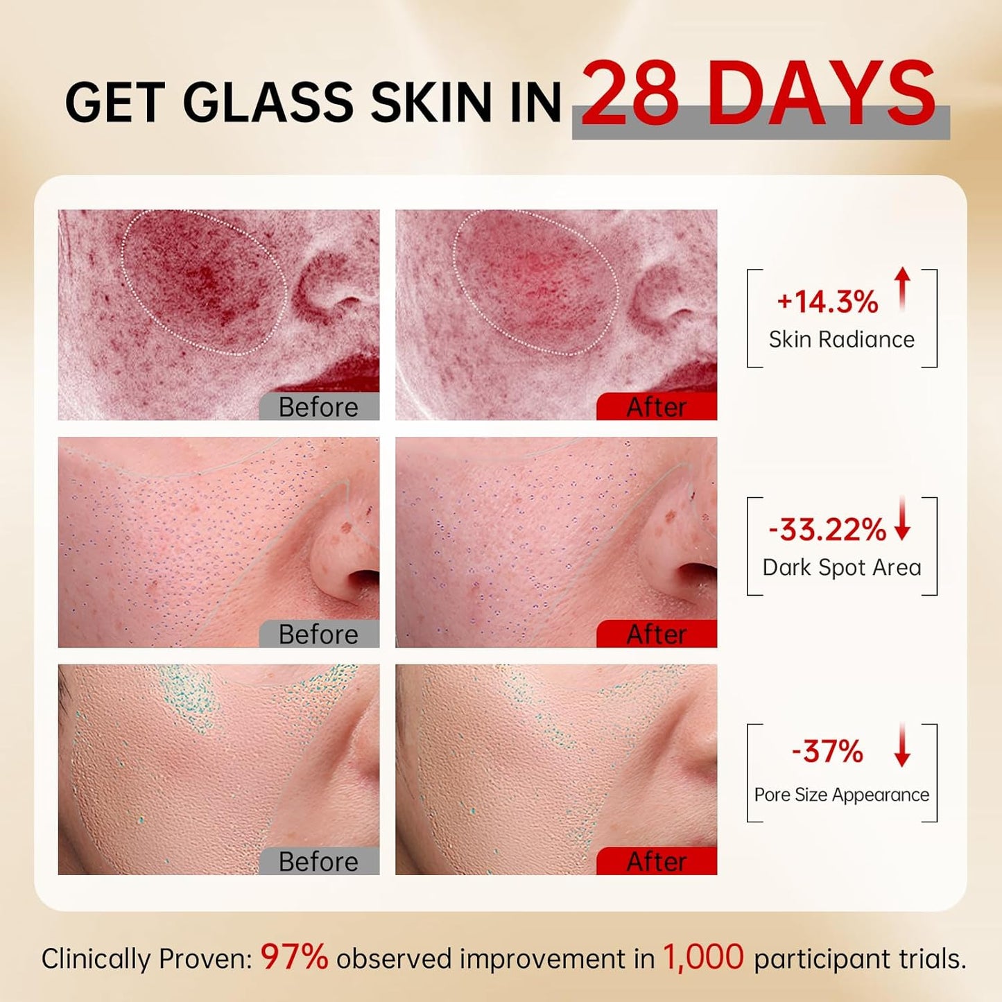 Zermet 1 Zermet 1  Skin Care Set, with Snail Mucin 92% Moisturizer 1.76 Oz & Vitamin C Face Serum 1.01 Oz, Daily Hydrating & Firming Skincare Routine Kit for All Skin Type