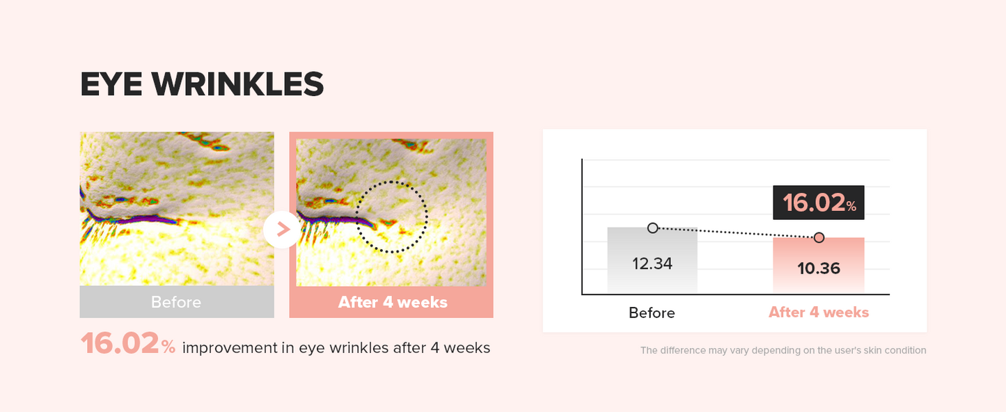 Zermet 1 Beauty of Joseon Revive Eye Serum with Retinal Niacinamide Correction for Puffy Eye Bags Fine Lines Dark Circles Wrinkles, Korean Skin Care 30ml, 1 fl.oz