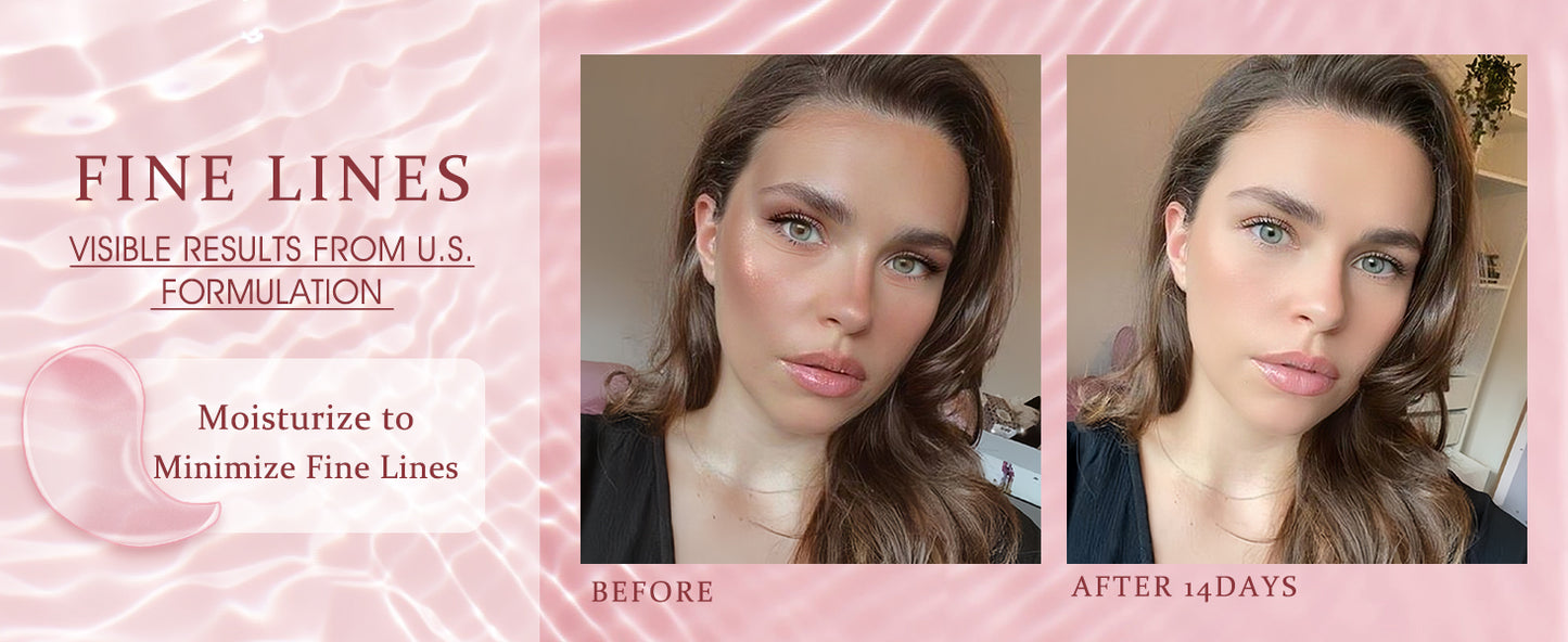 Zermet 1 Under Eye Patches Masks - for Dark Circles, Puffiness, Eye bags,and Fine Lines Smoothing Skin Care Treatment with Collagen and Hyaluronic Acid for Women and Men, (60 Pcs) Pink