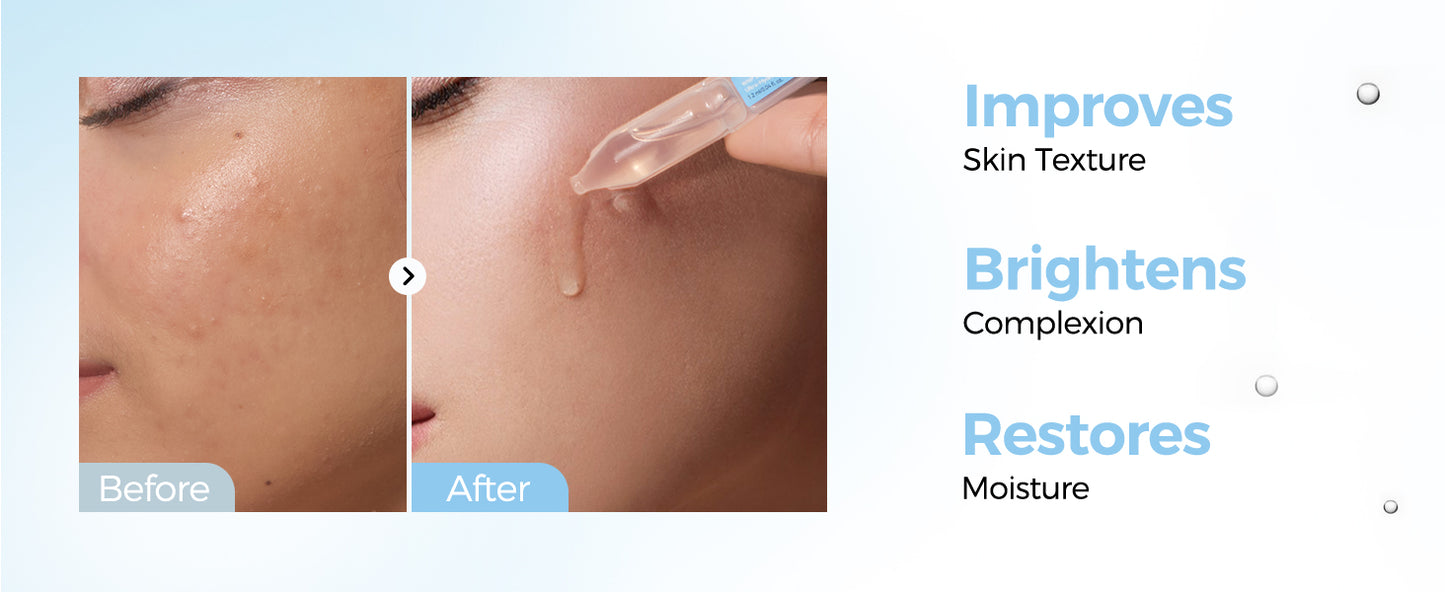 Zermet 1 Zermet 1  3% 4D Hyaluronic Acid Serum Ultra Hydrating Serum Smoother Skin|Pre-makeup SkinCare|Anti-Aging serum for face Single-Use Vials Skincare for Dry&Sensitive skin(1.2 ml)*30