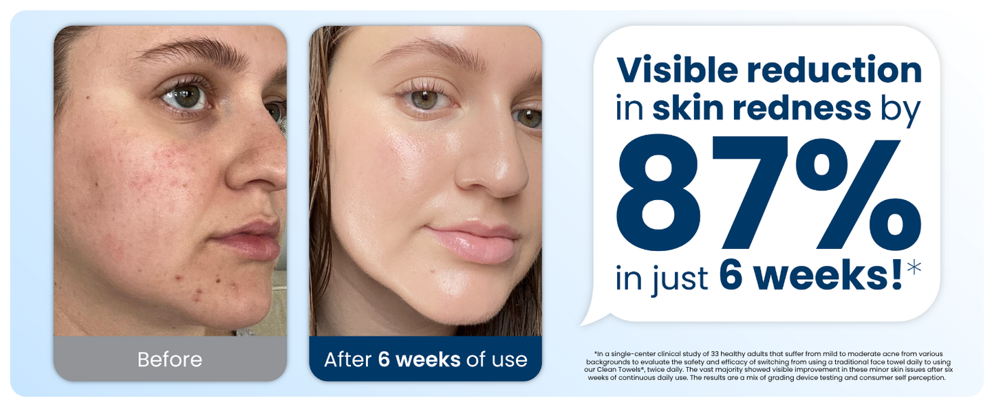 Zermet 1 Clean Skin Club Clean Towels XL™, 100% USDA Biobased Face Towel, Disposable Face Towelette, Eczema Association Accepted, Makeup Remover Dry Wipes, Ultra Soft, 50 Ct, 1 Pack