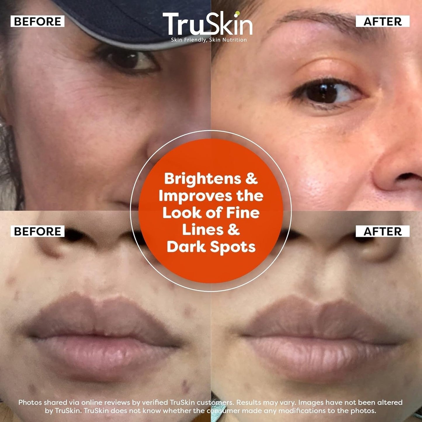 Zermet 1 TruSkin Vitamin C Serum For Face – Anti Aging Face Serum with Vitamin C, Hyaluronic Acid, Vitamin E – Brightening Formula – Improve Appearance of Dark Spots, Tone, Fine Lines & Wrinkles, 1 Fl Oz