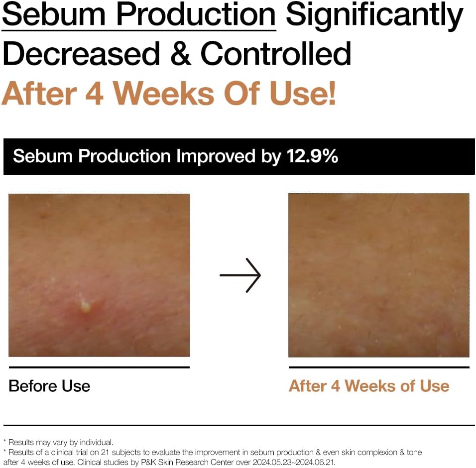 Zermet 1 Zermet 1 Rice 70 Glow Milky Toner, for Glass Skin, Rice Water, Niacinamide, Ceramides, Panthenol, Fragrance-Free, Non comedogenic, Fungal Acne Safe, Korean Skin Care, 250ml/8.45fl.oz.