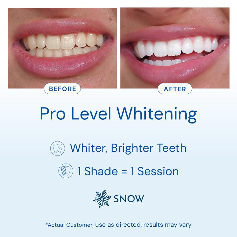 SNOW Diamond LED Teeth Whitening Kit | Gentle & Enamel Safe | at-Home Dental Care, Hygiene & Tooth Whitening | Portable & Convenient Oral Tooth Care