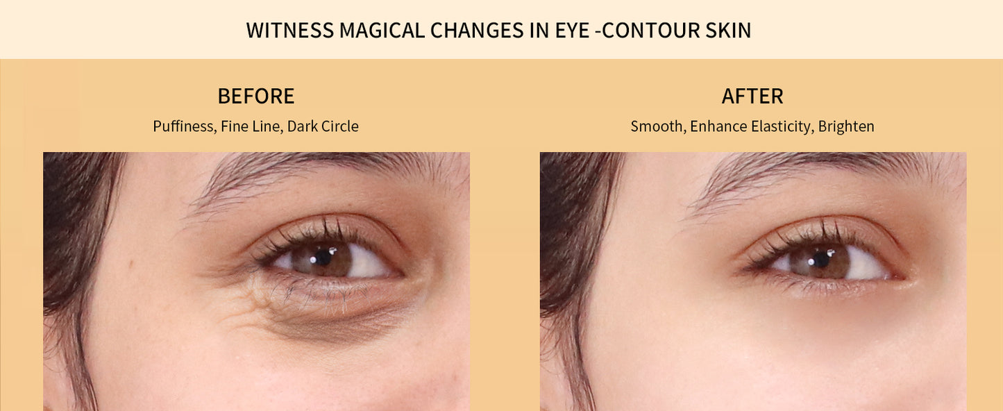 Zermet 1 Under Eye Patches Gold and Hyaluronic Acid for puffy eyes,Rose Eye Masks for Dark Circles and Puffiness skin care Smooth Wrinkles products 30 Pairs