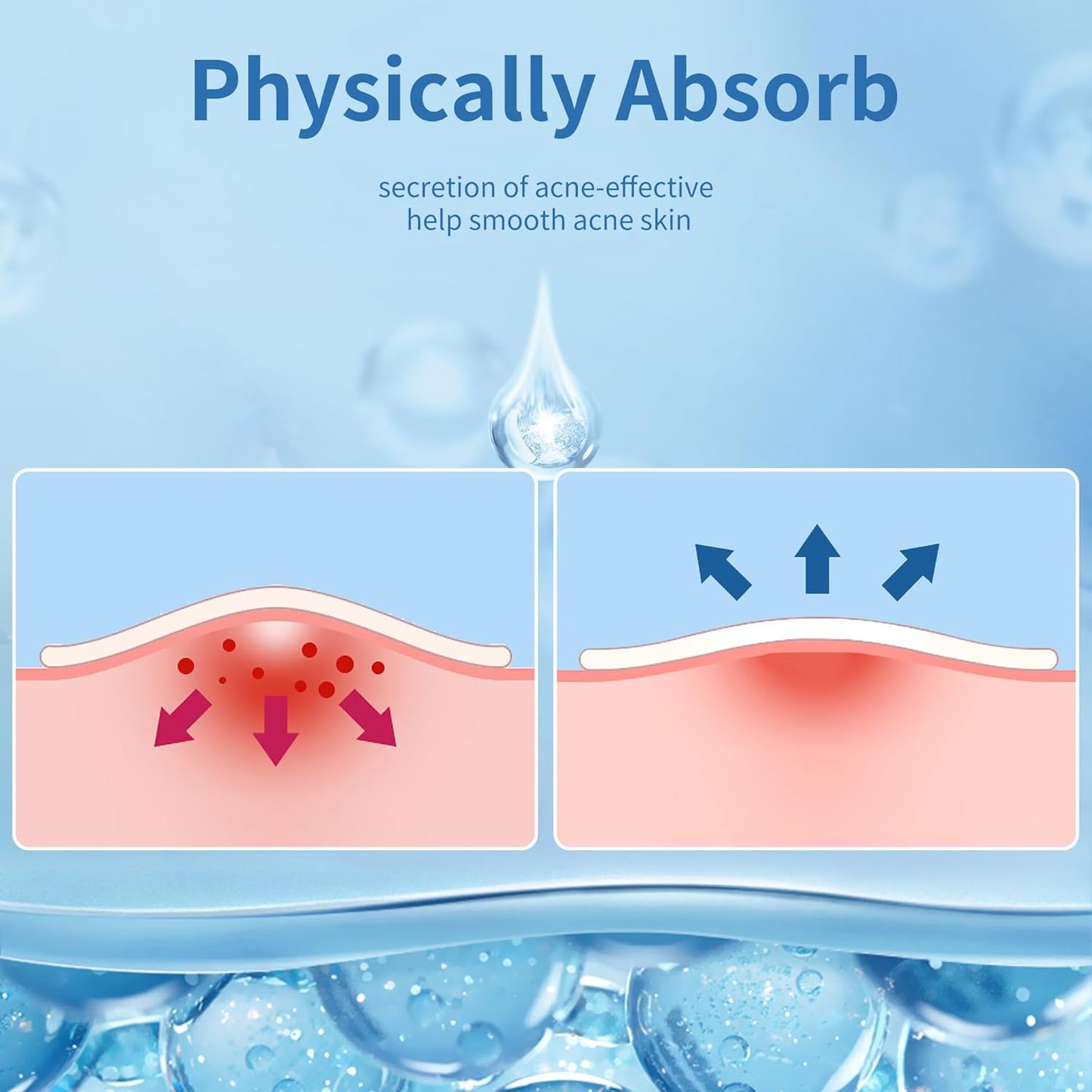 Zermet 1 Pimple Patches for Face, 4 Size 300 Counts Acne Patches, Hydrocolloid Patches for Covering Zits and Blemishes, Spot Stickers with Salicylic Acid, Tea Tree Oil & Calendula Oil