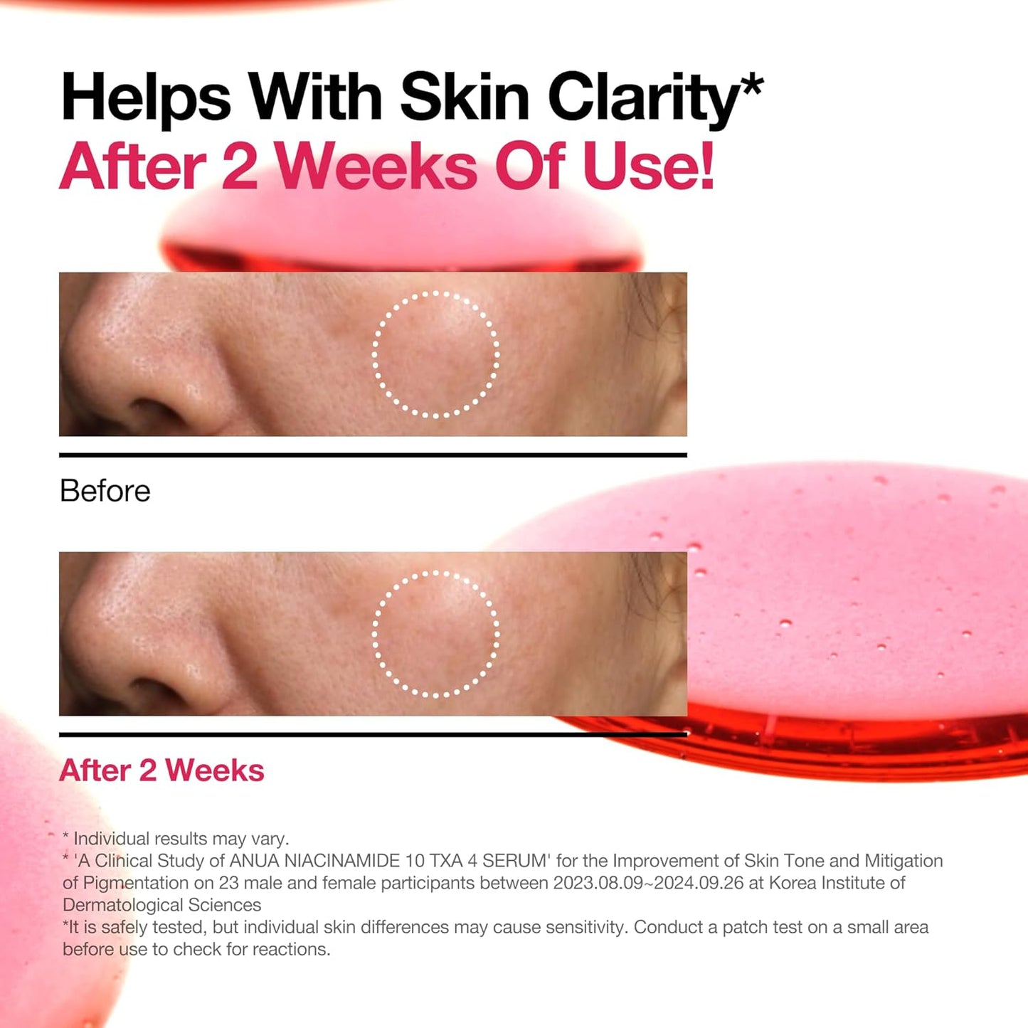 Zermet 1 Zermet 1 Niacinamide 10 + TXA 4 Serum, Hyaluronic Acid, Tranexamic acid, Facial Serum for Glass Skin, Clarifying, Radiant Complexion with Natural Color, Korean Skin Care (30ml /1.01 fl.oz)