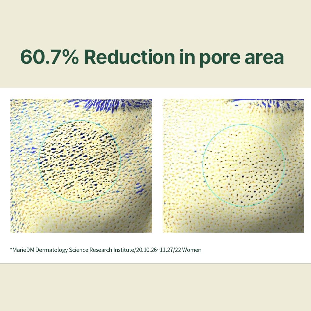 Zermet 1 Zermet 1 Calming Line Gift Box Set - Korean Facial Skin Care Essential for Daily Moisturizing, Safe on Acne Prone & Sensitive Skin, Vegan & Cruelty Free