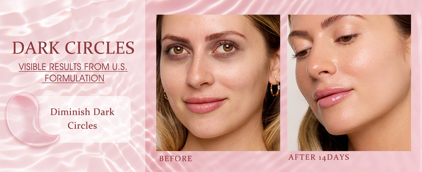 Zermet 1 Under Eye Patches Masks - for Dark Circles, Puffiness, Eye bags,and Fine Lines Smoothing Skin Care Treatment with Collagen and Hyaluronic Acid for Women and Men, (60 Pcs) Pink