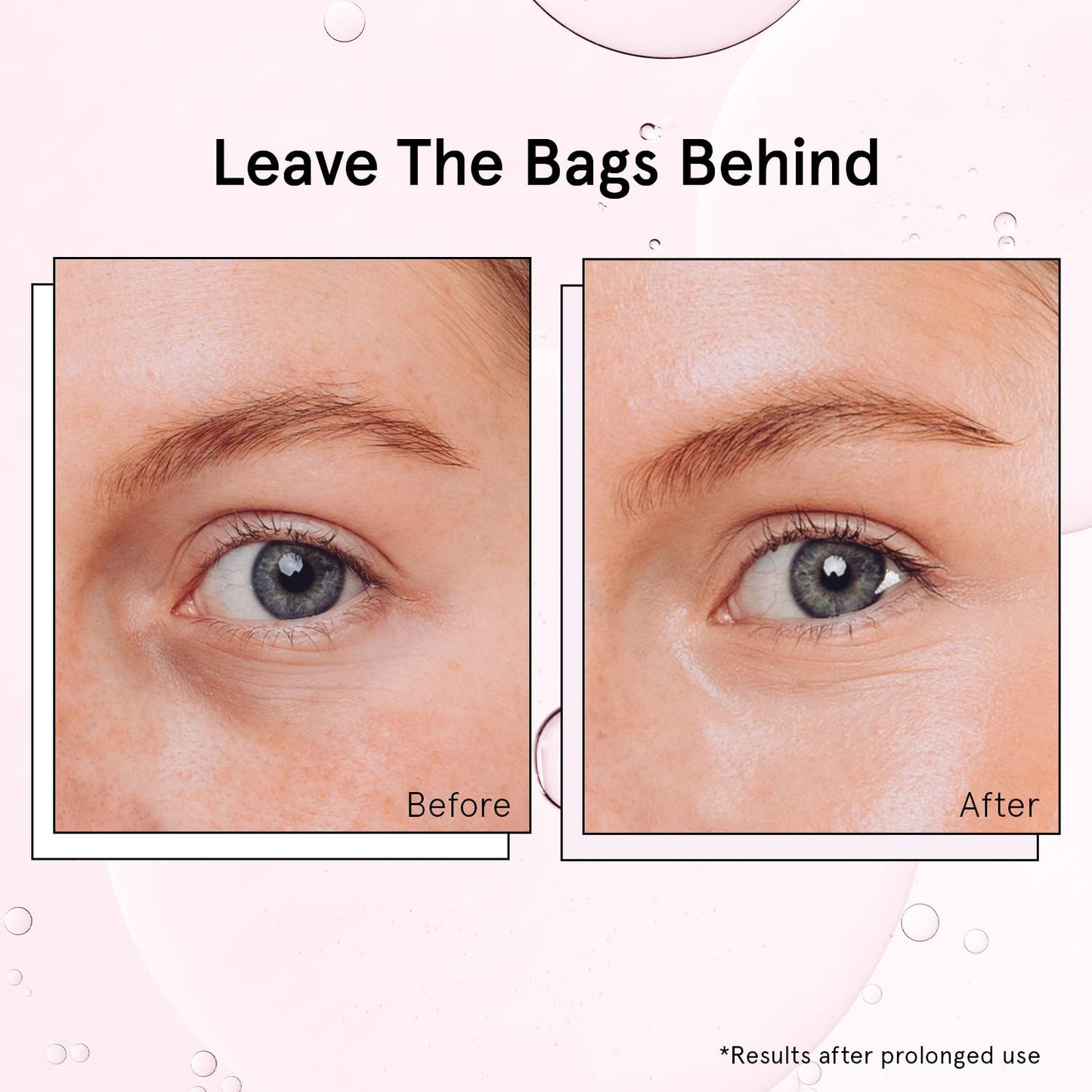 Zermet 1 grace & stella Award Winning Under Eye Brightener Roller - Airplane Travel Essentials - Retinol & Caffeine Eye Serum for Puffiness, Dark Circles, Wrinkles - Vegan Skincare (15ml / 0.51floz)