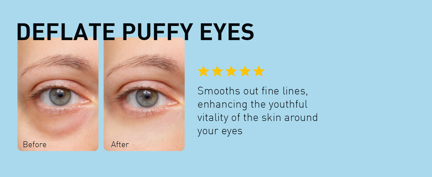 Zermet 1 Enaskin Naturals Under Eye Patches for Dark Circles: 30 Pairs Retinol Collagen Eye Gels Mask - Reduce Wrinkles Puffy & Bags - Skin Treatment Pads - Anti Aging Moisturizer For Women (Blue)