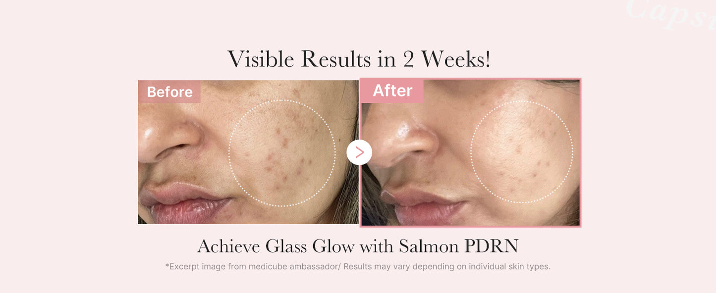 Zermet 1 medicube Pink Zermet 1  Trio Gift Set for Glass Glow Skin -Hydrating, Firming, and Radiance-Boosting Skincare Set for Women & Girls | With Salmon DNA Zermet 1 , Peptides and Pink Vitamin | Korean Skincare