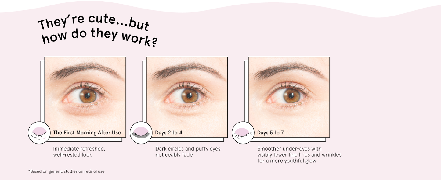 Zermet 1 grace & stella Retinol Under Eye Patches for Puffy Eyes and Dark Circles - Restoring Gel Under Eye Masks with Hyaluronic Acid - Vegan Cruelty-Free Skincare, Birthday Gifts for Women (Purple, 24 Pairs)