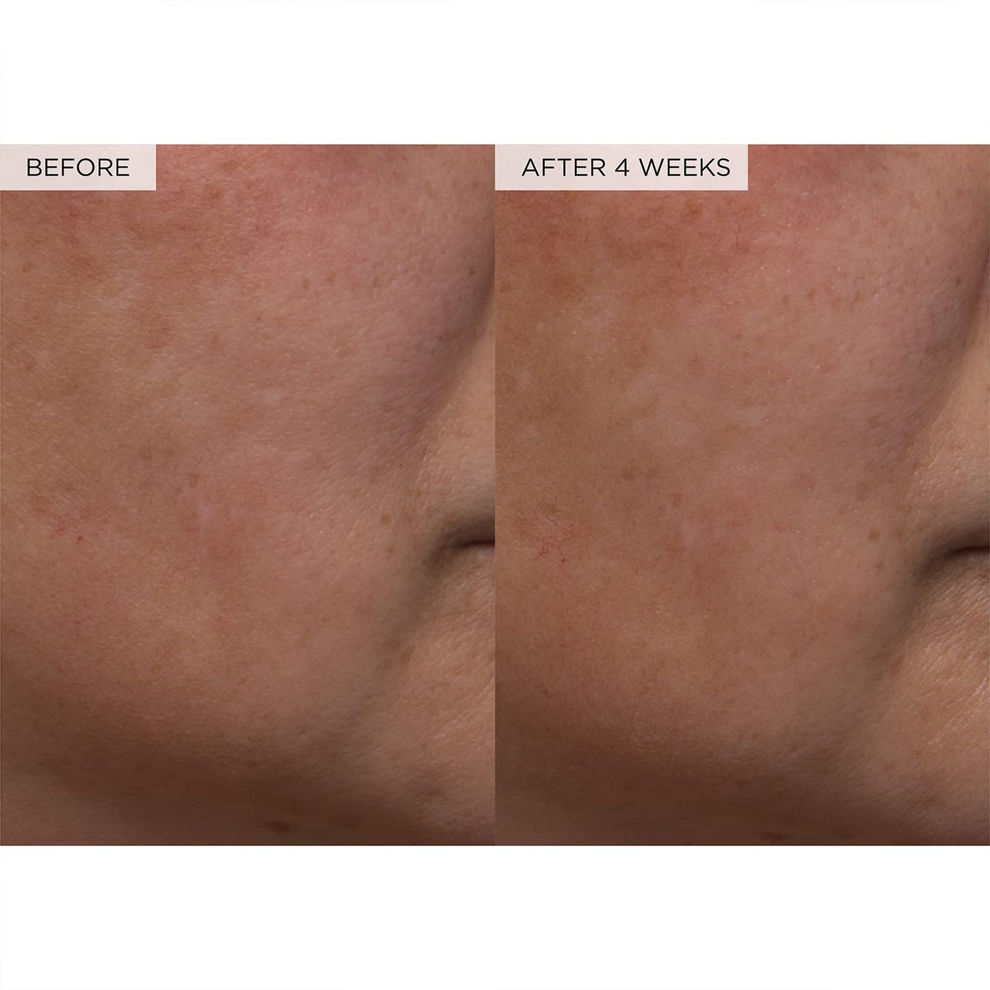 Zermet 1 Glow Recipe PHA + BHA Face Toner - Korean Skin Care Pore Minimizer & Gentle Facial Exfoliator for Tightening, Hydrating & Exfoliating - Glycerin, Watermelon & Cactus Water (40ml)