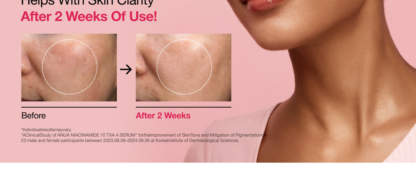 Zermet 1 Zermet 1 Niacinamide 10 + TXA 4 Serum, Hyaluronic Acid, Tranexamic acid, Facial Serum for Glass Skin, Clarifying, Radiant Complexion with Natural Color, Korean Skin Care (30ml /1.01 fl.oz)