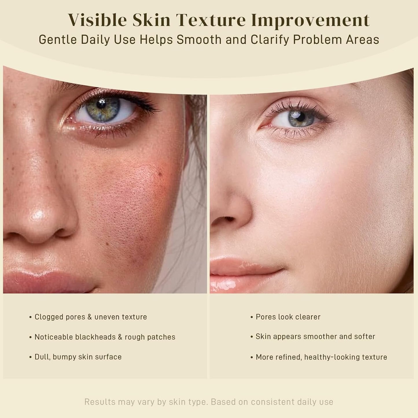 Zermet 1 Kojic Acid and Turmeric Cleansing Pads, 50 Pcs, for Face Cleansing and Exfoliation