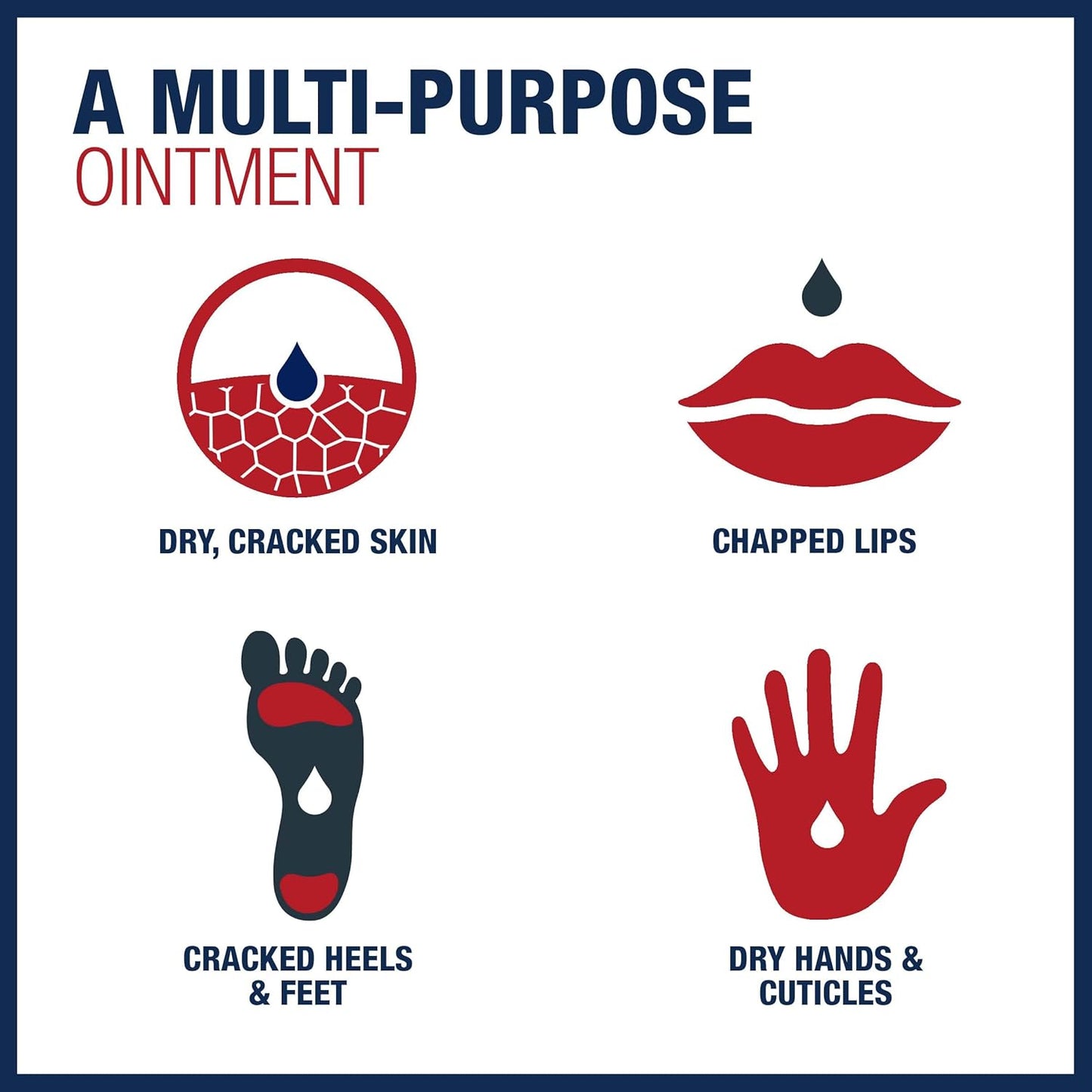 Zermet 1 Aquaphor Healing Ointment Advanced Therapy Skin Protectant Skin Care Set, Body Moisturizer for Dry Skin, Minor Cuts and Burns, Dry Cuticles, Cracked Heels, Hands and Lips, 14 Oz Jar + 1.75 Oz Tube