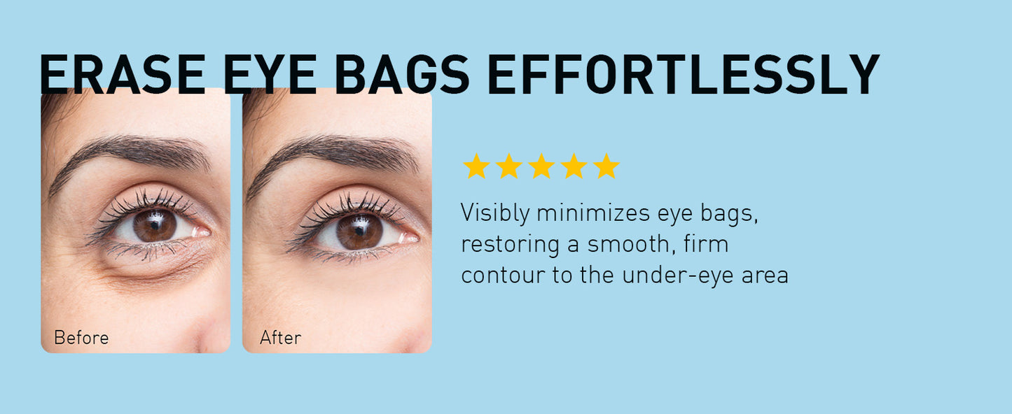 Zermet 1 Enaskin Naturals Under Eye Patches for Dark Circles: 30 Pairs Retinol Collagen Eye Gels Mask - Reduce Wrinkles Puffy & Bags - Skin Treatment Pads - Anti Aging Moisturizer For Women (Blue)