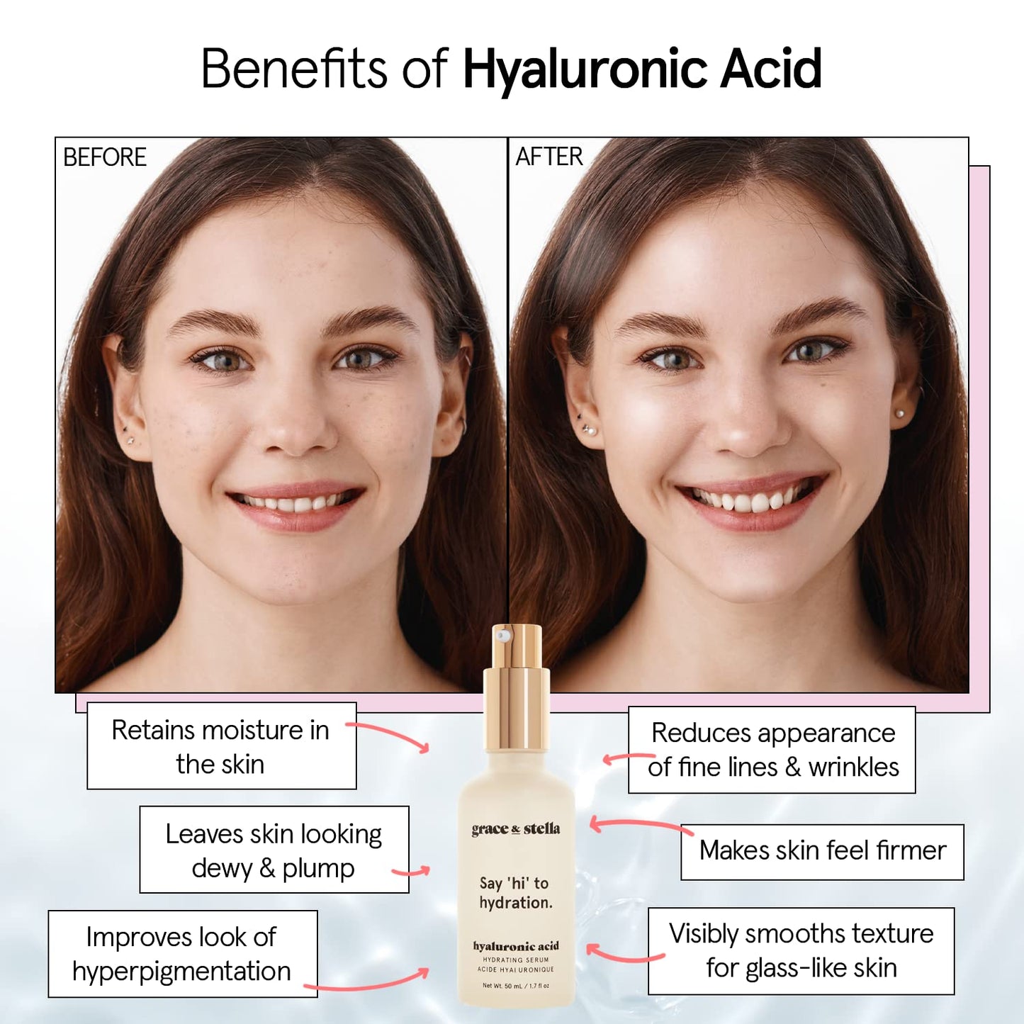 Zermet 1 grace & stella Award Winning Hyaluronic Acid Serum (50ml/1.7 fl oz) Hydrating Hyaluronic Acid Serum for Face - Acido Hialuronico for Women - Remove Fine Lines, Wrinkles, Anti Aging - Vegan Skincare
