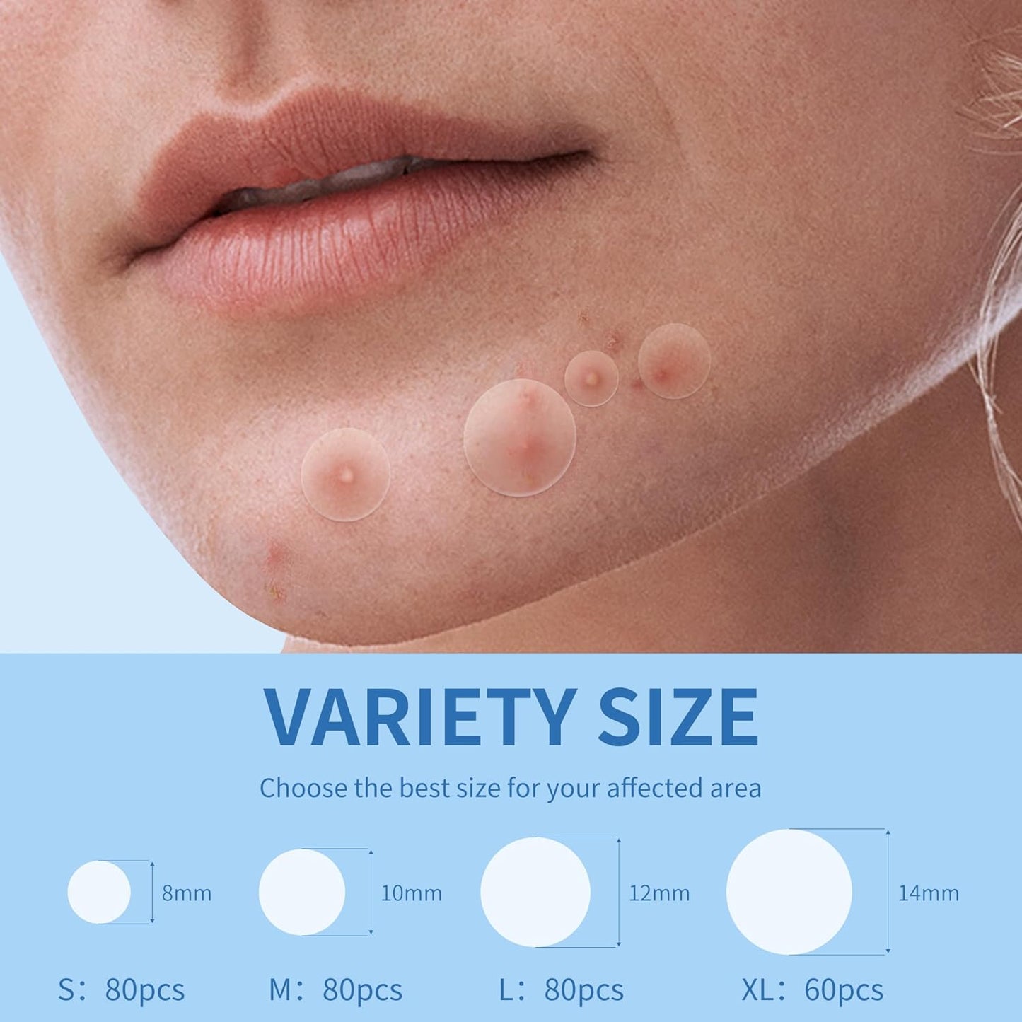 Zermet 1 Pimple Patches for Face, 4 Size 300 Counts Acne Patches, Hydrocolloid Patches for Covering Zits and Blemishes, Spot Stickers with Salicylic Acid, Tea Tree Oil & Calendula Oil