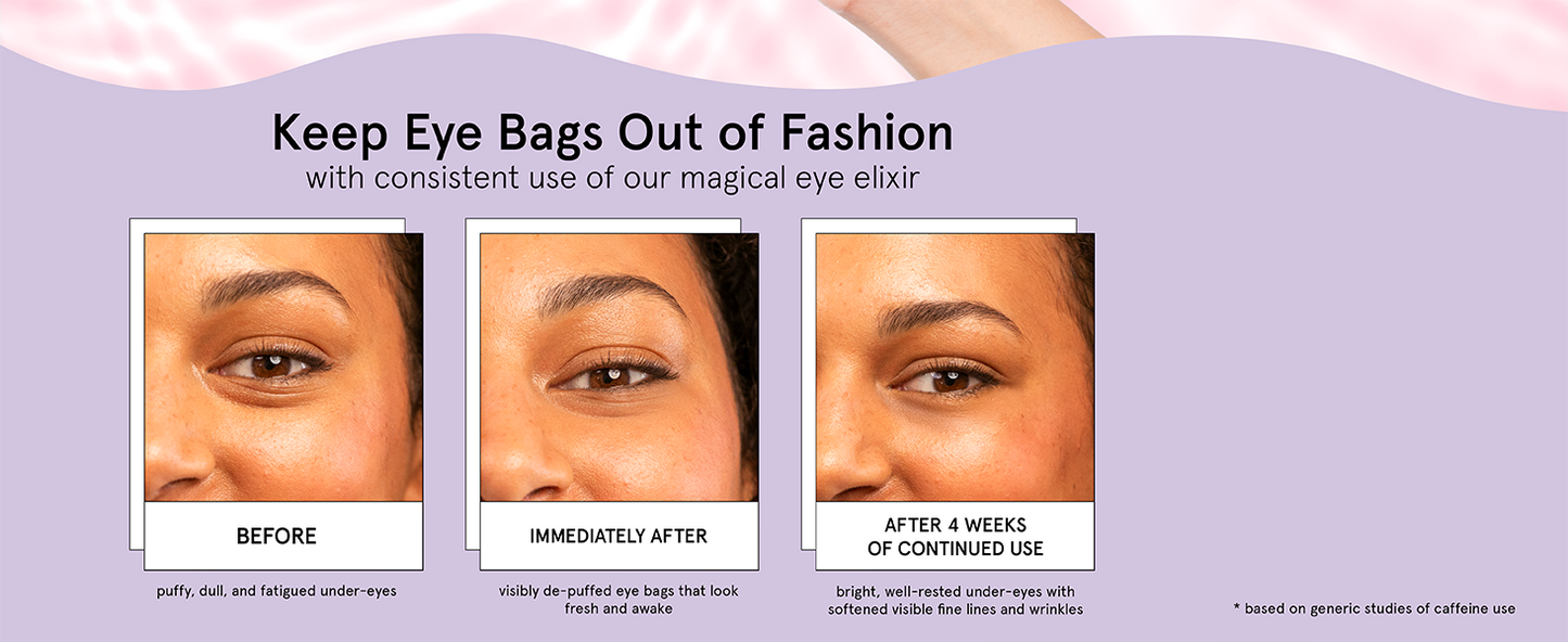 Zermet 1 grace & stella Award Winning Under Eye Brightener Roller - Airplane Travel Essentials - Retinol & Caffeine Eye Serum for Puffiness, Dark Circles, Wrinkles - Vegan Skincare (15ml / 0.51floz)