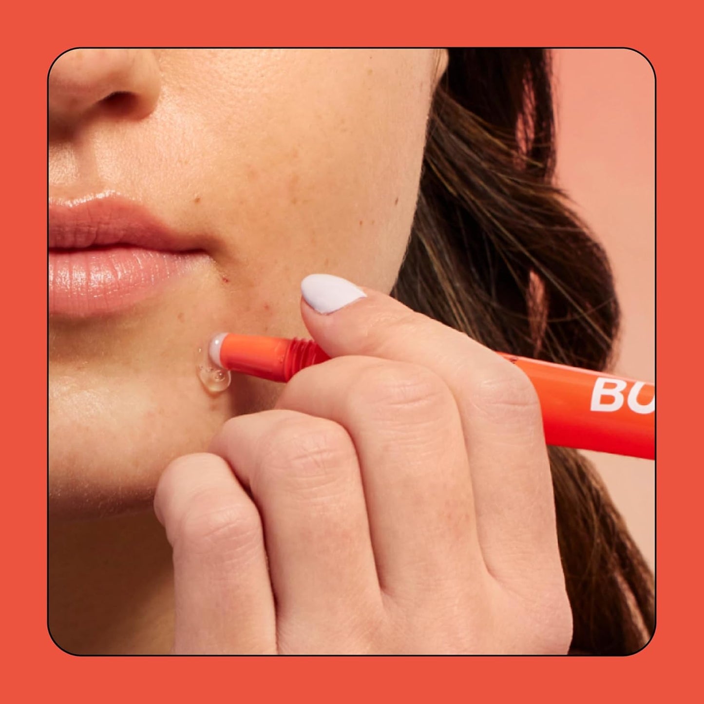 Zermet 1 Zermet 1 Skincare Knock Out 1.8% Salicylic Acid Acne Spot Treatment - Deep Cleansing Blemish Spot Treatment with Wintergreen & Willow Bark Extract - Clarifies & Calms Oily Skin (10ml)