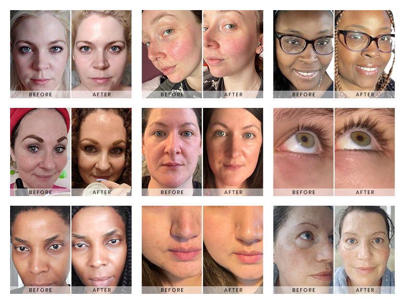 Zermet 1 Eclat Skincare Vitamin C Face Serum - Skin Care for Dark Spots, Vitamin C Serum with Hyaluronic Acid, Ferulic Acid, & Vit E - Anti Aging and Skin Brightening, Pure Vit C Facial Care - 30 ml