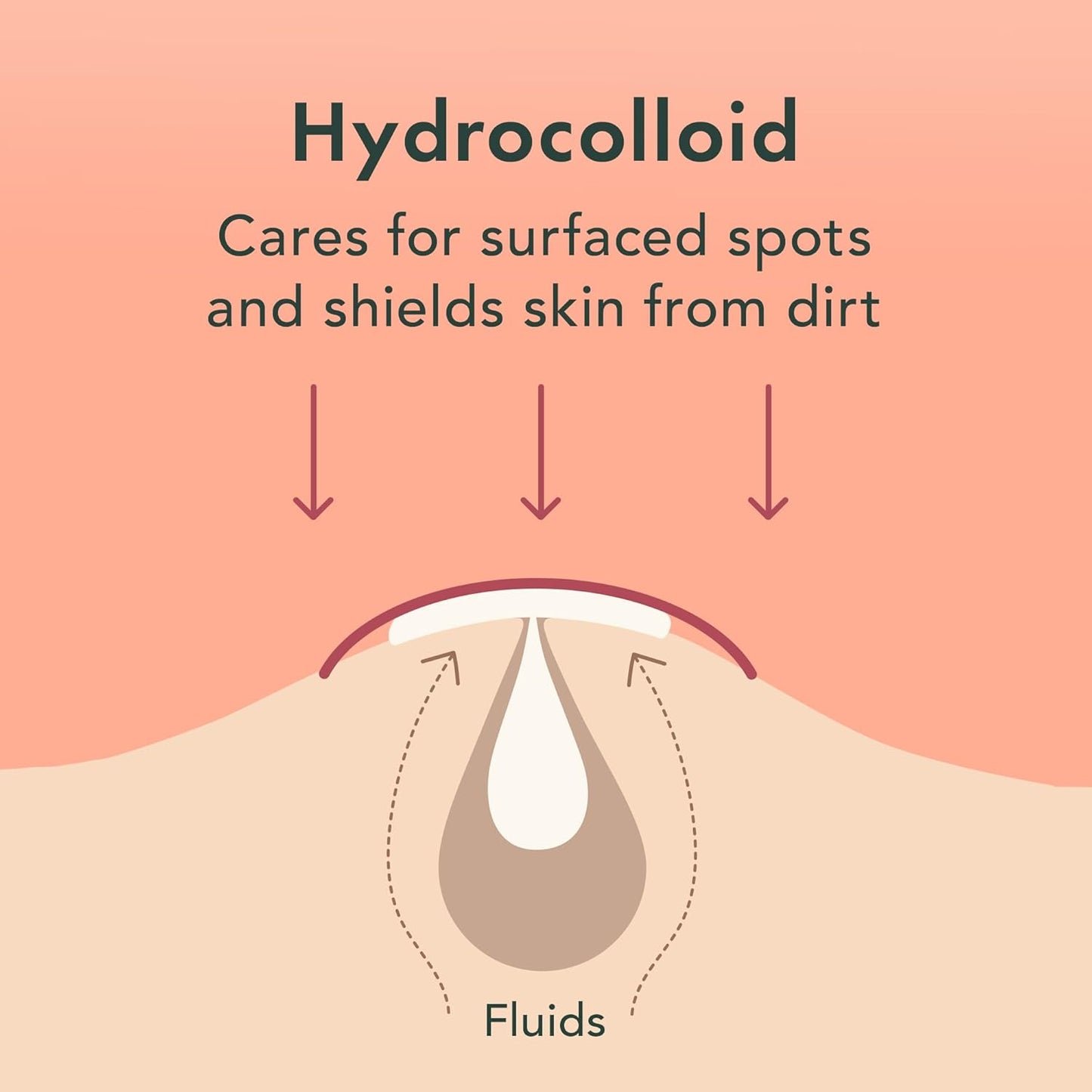 Zermet 1 Rael Pimple Patches, Miracle Invisible Spot Cover - Hydrocolloid Acne Patch, Treatment for Breakouts, Absorbs Zits & Blemish, Korean Skin Care, 2 Sizes (96 Count)