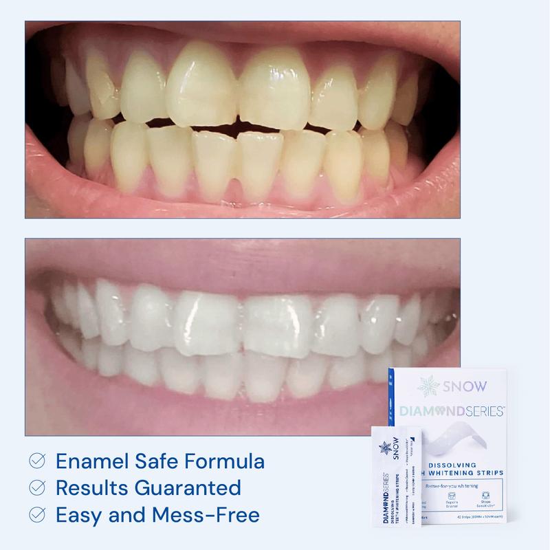 Zermet Diamond Teeth Whitening Strips | Gentle & Enamel Safe White Strips for Teeth Whitening | at Home Dental Hygiene & Tooth Care for a White Smile