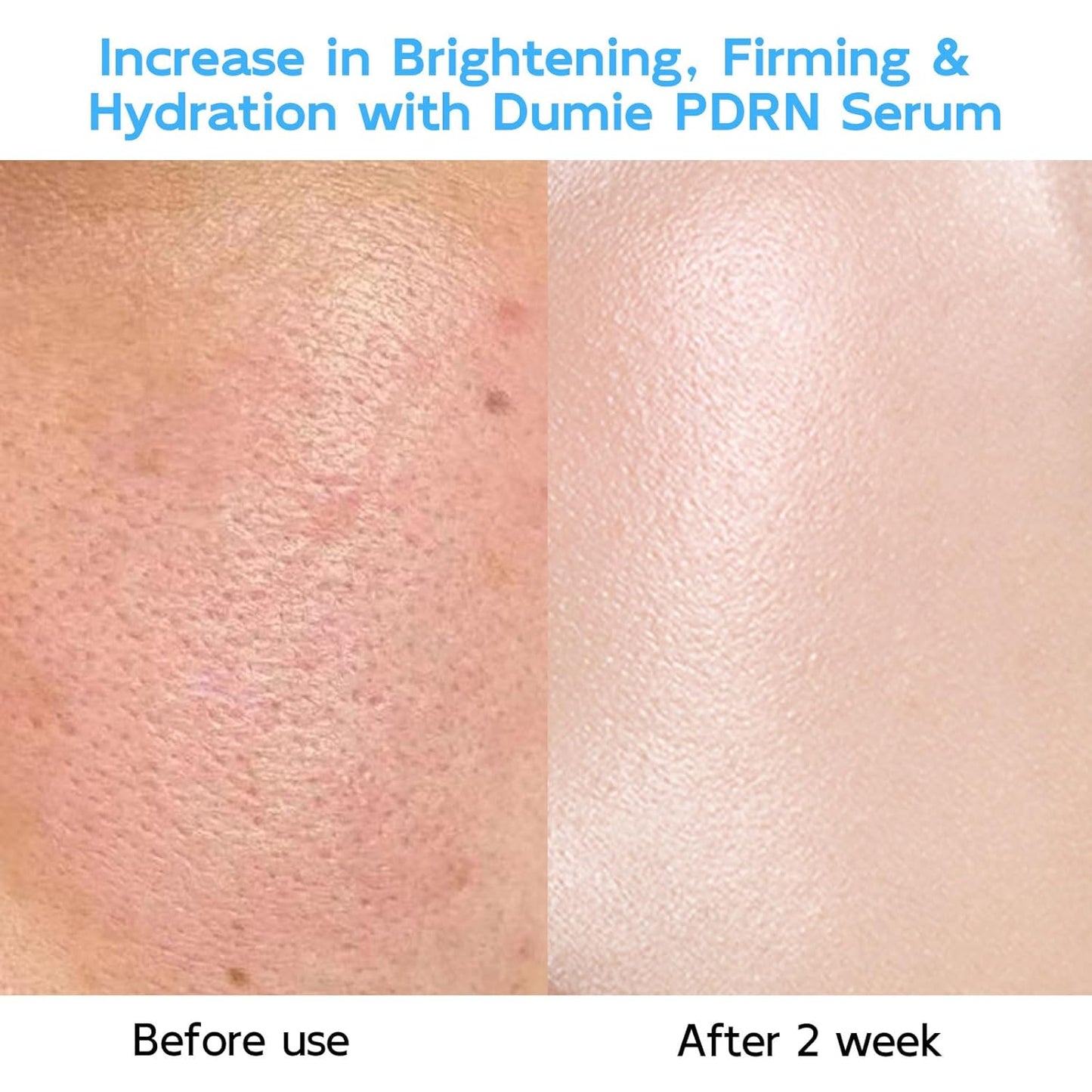 Zermet 1 Salmon DNA Zermet 1  Anti-Aging Serum, 5000ppm Salmon Egg DNA Ampoule, 2000ppm Collagen, Glutathione, Niacinamide & 6 Hyaluronic Acids, Korean Skincare for Wrinkles & Radiance,0.05 fl.oz x 30e