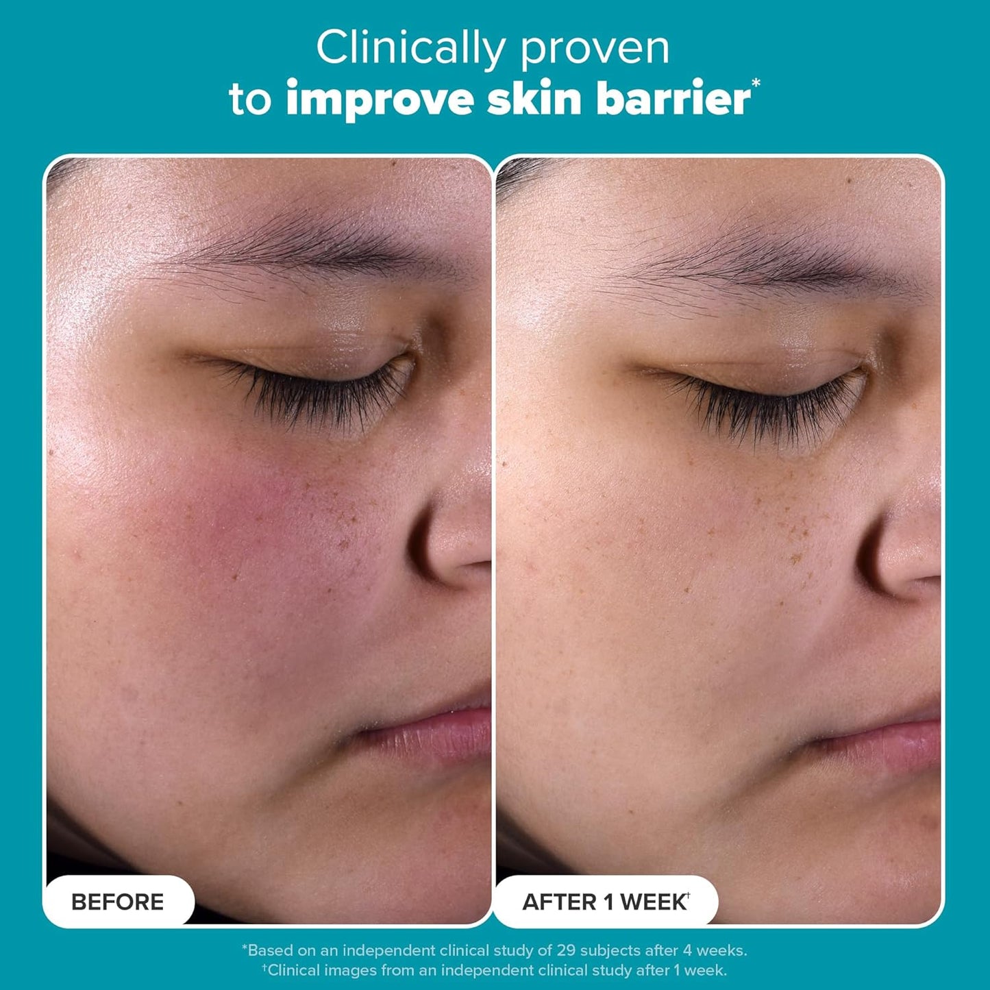 Zermet 1 Paula's Choice SKIN PERFECTING 2% BHA Liquid Exfoliant Polish, Salicylic Acid Facial Exfoliator Polish for Enlarged Pores, Wrinkles & Fine Lines, Suitable for Blackhead-Prone Skin, Fragrance-Free