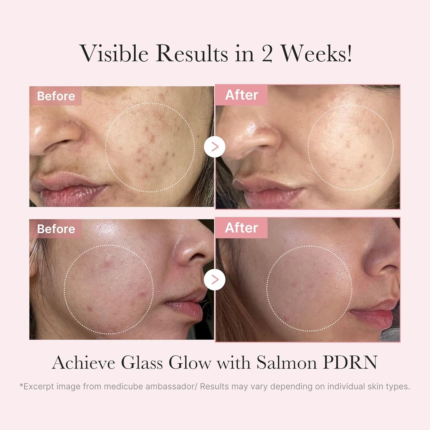 Zermet 1 medicube Salmon DNA Zermet 1  Trial Kit | Glass Glow Mini Skincare Set with Toner, Serum & Sheet Mask for Hydrating, Firming, Moisturizing |Gift & Travel Essentials for Women & Girls | Korean Skincare