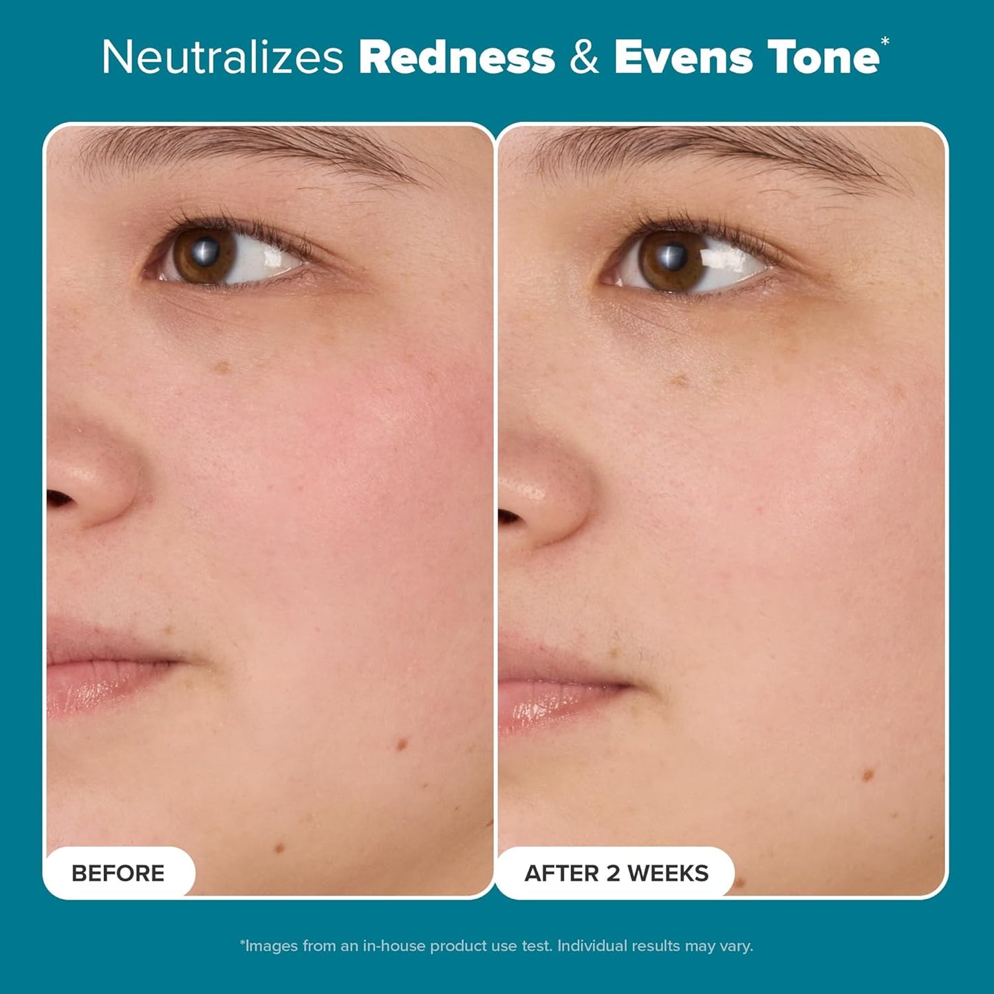 Zermet 1 Paula's Choice SKIN BALANCING Pore-Reducing Face Toner with Niacinamide, for Oily Skin & Combination, Minimizes Large Pores, Controls Oil & Shine, Hydrates & Replenishes, Fragrance-Free