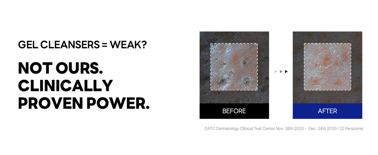 Zermet 1 Zermet 1 Birch Juice Moisturizing Cleanser | Unclogs hidden sebum, Clears away dead skin cells., Soothing, Low pH, Gel Type Cleanser (5.07 fl.oz)